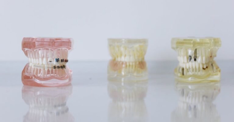 What You Can Do To Whiten Your Teeth